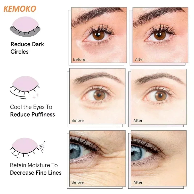 LED Micro Current Pulse- Eye Massager